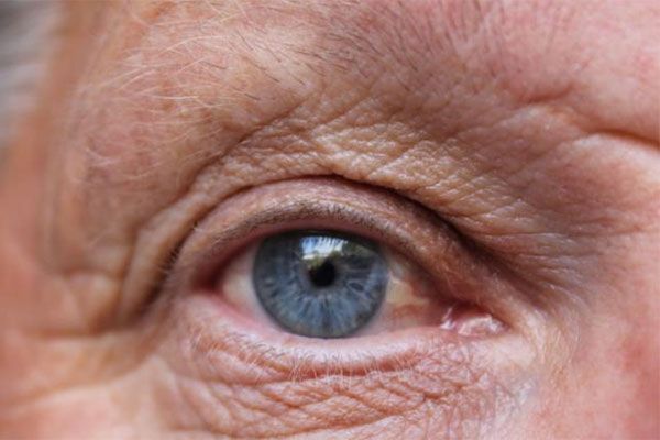 The Aging Eye